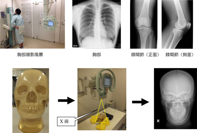 一般撮影検査とは