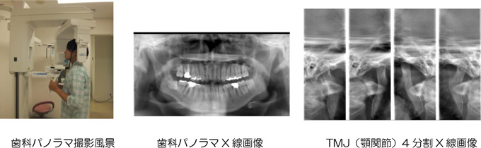 CT検査とは