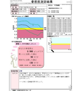 代表的検査