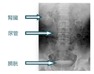 泌尿器検査